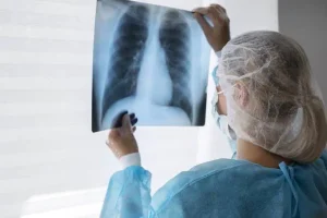 tuberculosis